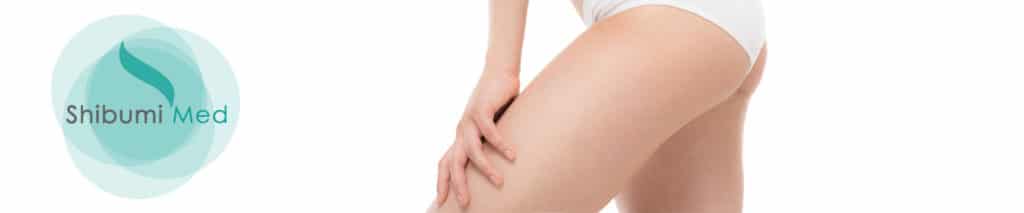 ShibumiMed_Lipocell-Tecnologia-HIFU ShibumiMed_Lipocell-Tecnologia-HIFU