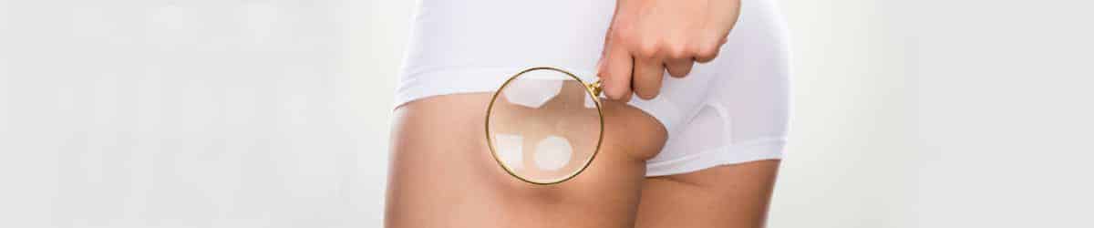 Mesoterapia - PEFS Cellulite - ShibumiMed_mob