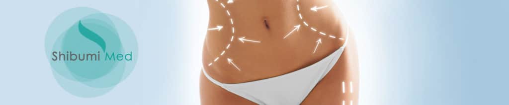 ShibumiMed_Lipoaspirazione ShibumiMed_Lipoaspirazione