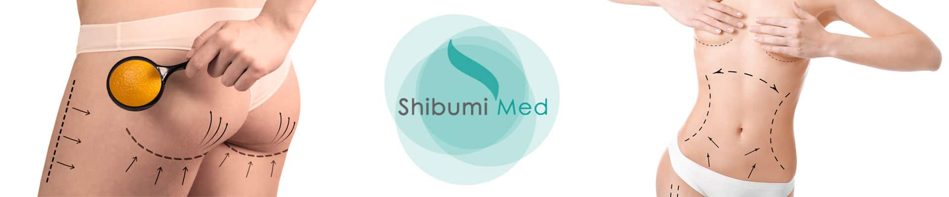 Medicina-Estetica-Torino-ShibumiMed